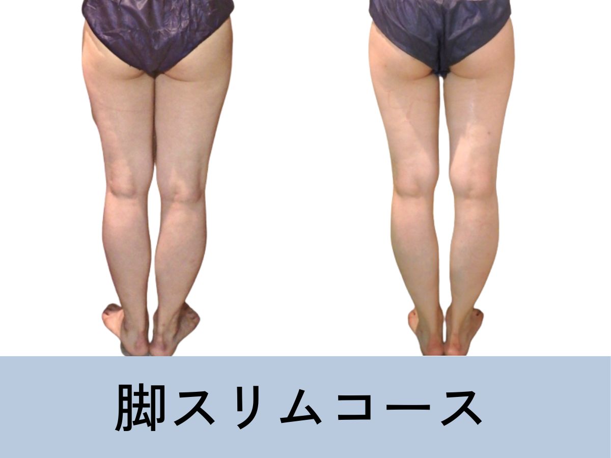 むくみは水分の取りすぎではなく水分不足だった！/Swelling: Not from Excess, but Lack of Water!