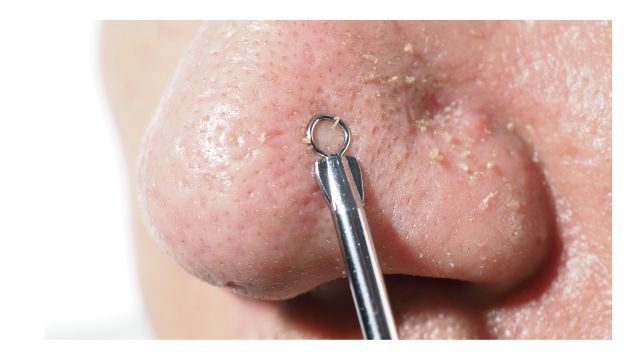 やめてよかった！毛穴開きを加速させるNG行動！/Stop It for Good! Habits to Avoid to Prevent Enlarged Pores!